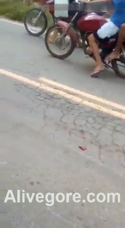 Motorcyclist lost an arm on the road