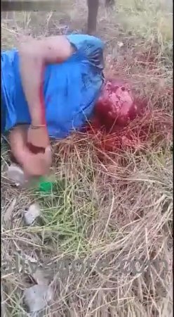 Young man gets machete to the neck