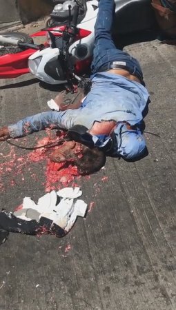 Motorcyclist's Head Crushed Through The Helmet