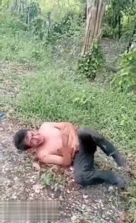 A man got hacked by machete and ended up dying by bullets.
