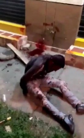 Man Brutally Got Thrown With Rock In Colombia