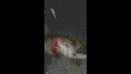 Penis Cut Off And Stabbed Multiple Times And Disemboweled