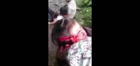 Child Warning! Two Children Attacked With Machete By Maniac