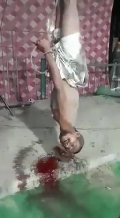 Man Hanging By Feet And Bleeding