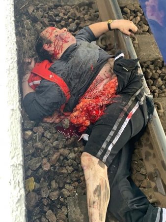 A Man Fell On The Railroad Tracks