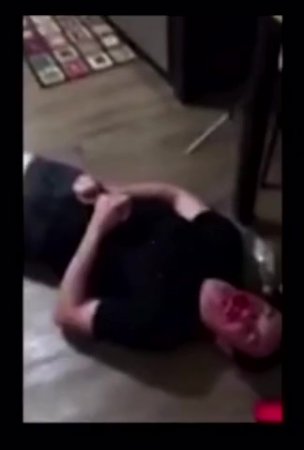 College Roommate Gets Beat To Bloody Pulp
