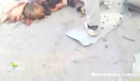 Pieces Of The Suicide Bomber's Body Scattered All Over The Road