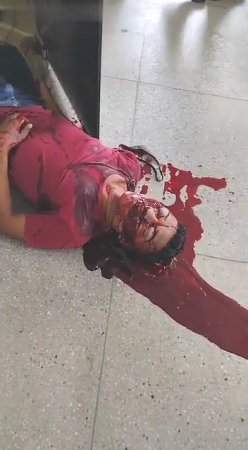 Man Drowning In His Blood