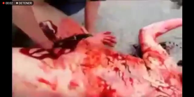 The Woman Had Her Guts Taken Out Through The Vagina ...