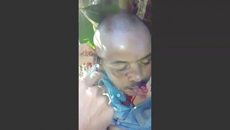 A Man's Ears Were Cut Off And Forced To Eat Them