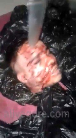 The Severed Head Of An Opponent Is Mutilated With A Knife