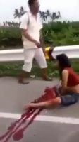 The Woman's Leg Was Left On The Motorcycle