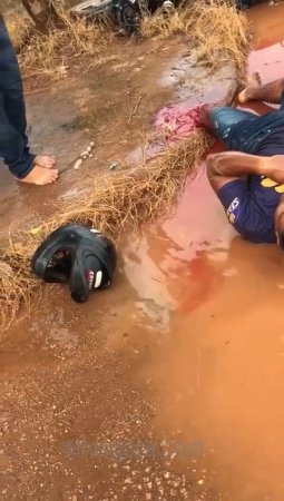 A Man Without A Leg Is Lying In A Muddy Puddle