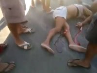 Woman After An Accident Dies Lying On The Road