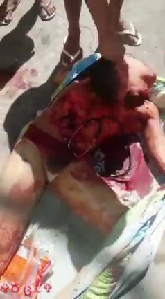 Doctor Beheaded » UncensoredVideo - Latest News Without Censorship