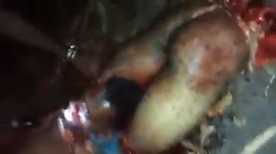 Installation Of Severed Arms, Legs And Head ... 