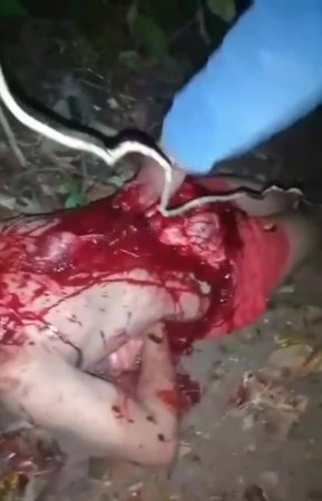 Dude Gutted With A Huge Knife