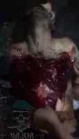 Dude Growls In Pain When They Cut Off The Skin On His Chest