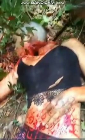 Body Of Bald Dead Woman Beheaded