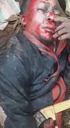 Dude Got Badly Burned While Trying To Steal An Electric Cable