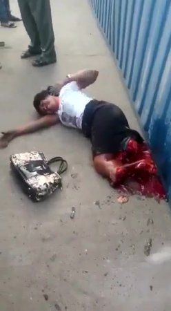 Woman Crushed Both Legs By A Collapsed Container From A Truck