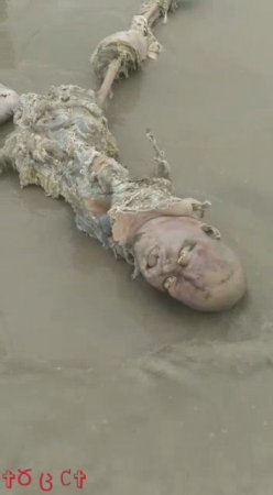 The Body Of A Drowned Person After A Long Stay In The Water