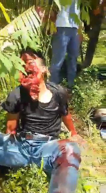 Without A Face » UncensoredVideo - Latest News Without Censorship