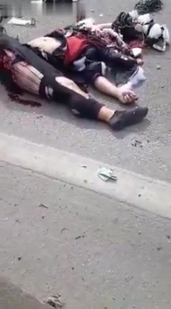 Motorcyclist Torn In Half In An Accident