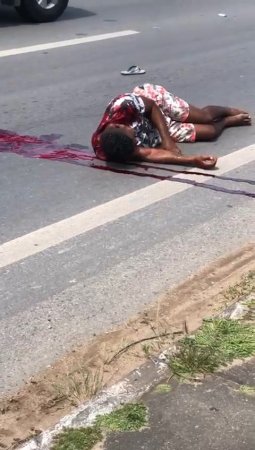 The Man Is Living Out His Last Seconds Lying In Blood On The Road