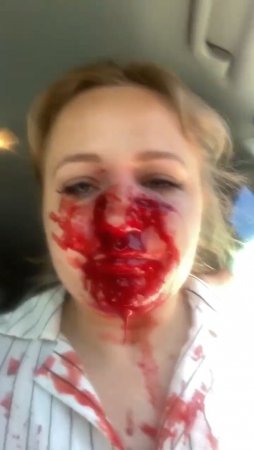 Dumb Blonde Accidentally Hurt Her Face With A Gunshot. USA, Oregon