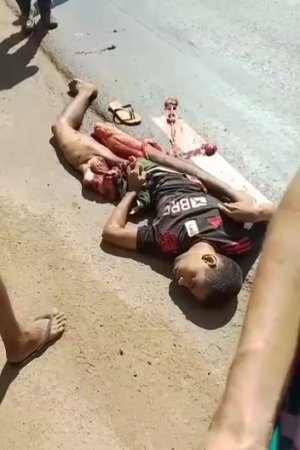 A Dead Motorcyclist And His Torn-off Legs