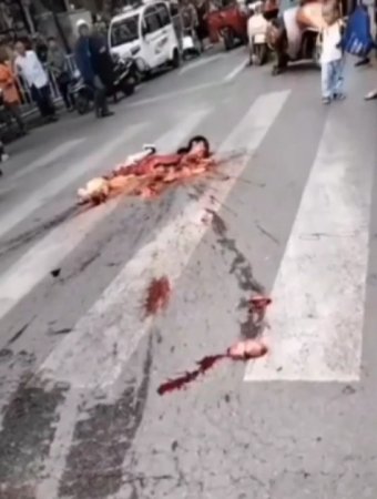 After The Accident, The Female Motorcyclist Was Left With Only A Head And A Foot