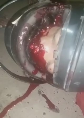 The Helmet Was Useless - The Motorcyclist's Head Was Smashed And He Died