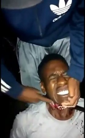 A Nigga With A Cut Throat Choking On His Own Blood