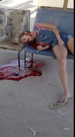 Woman Lying In A Pool Of Blood At A Bus Stop