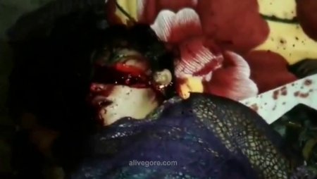 A Dying Woman With Her Skull Slashed Across