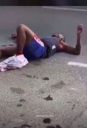 A Man Dies Lying On The Road With His Guts Spilling Out