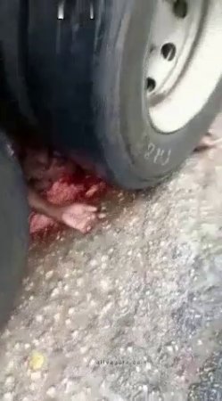 Dude Crushed By A Truck, Only One Arm And Legs Left