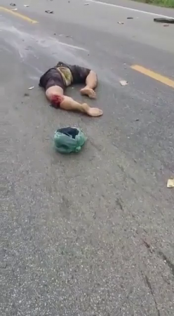 The Motorcyclist Was Torn In Half As A Result Of The Accident