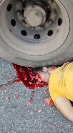 A Man's Head Crushed By The Wheels Of A Truck