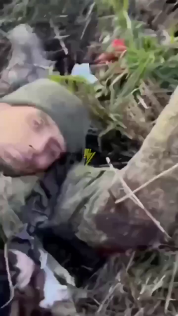 Russian Army Soldier Had His Leg Torn Off