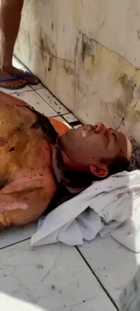 Dude Is Badly Burned By An Electric Shock And Dies Lying On The Ground