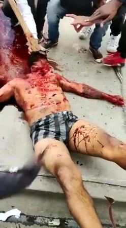 A Bunch Of Men With Knives Turn A Dude's Body Into Minced Meat