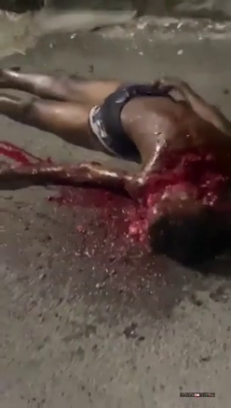 Dude's Face Is Turned Into A Bloody Mess With A Machete