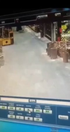 A Worker Has To Have Leg Amputated After Not Paying Attention And Being Hit By Forktruck. Russia