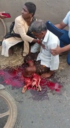 An Elderly Man Lost Both His Legs. India
