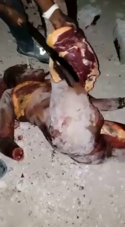 The Body Of A Murdered Woman Accused Of Witchcraft Will Go To The Meat Market. Haiti