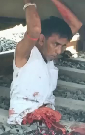 The Man Tries To Sit Down And Can't Because He Doesn't Have An Ass Anymore. India
