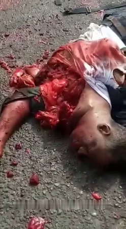 The Heart Of A Man Mutilated In An Accident Continues To Beat While Lying On The Pavement