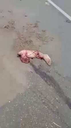 Dead Motorcyclist On The Road With His Legs Cut Off